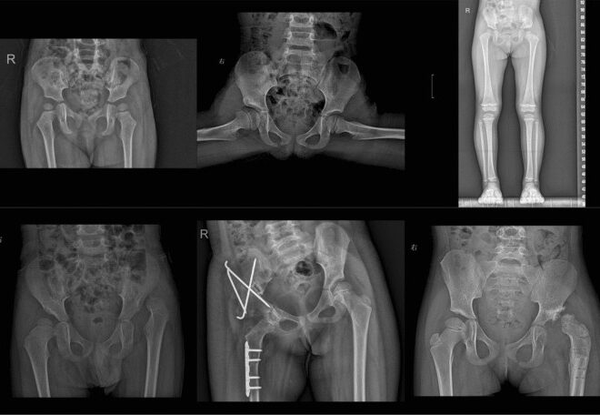 Ray and PyTorch are finally under one roof. Good riddance to the anxiety.